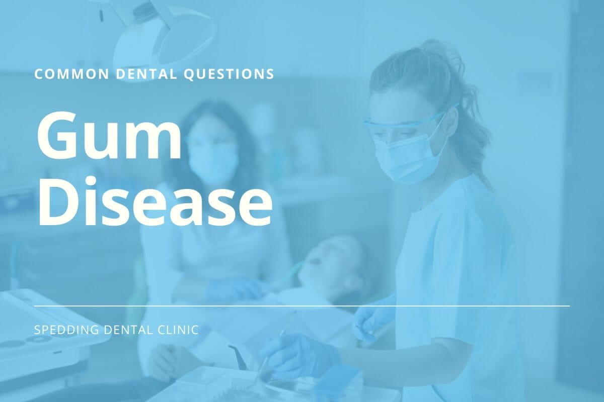 Common Dental Questions About Gum Disease