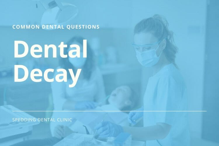 Common Questions About Dental Decay