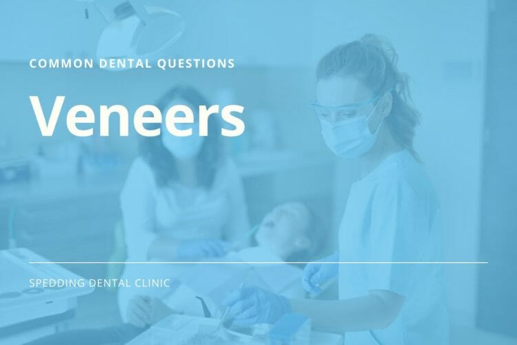 Common Questions About Veneers