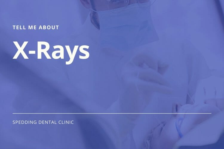x-Rays