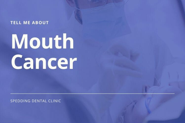 Mouth Cancer