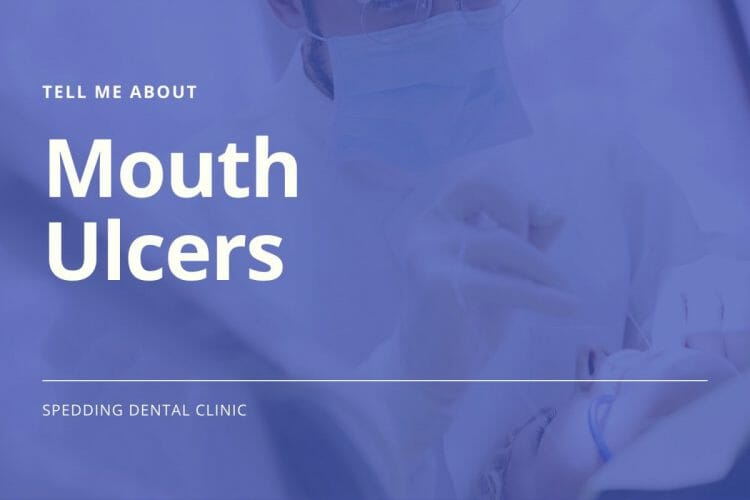 Mouth Ulcers