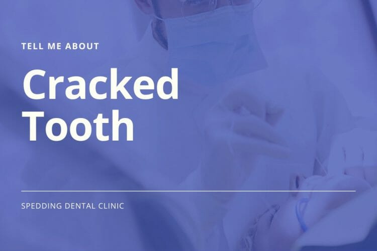 Tell Me About Cracked Tooth