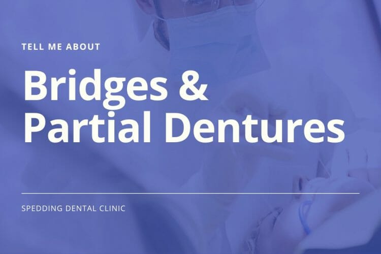 Tell Me About Bridges & Partial Dentures