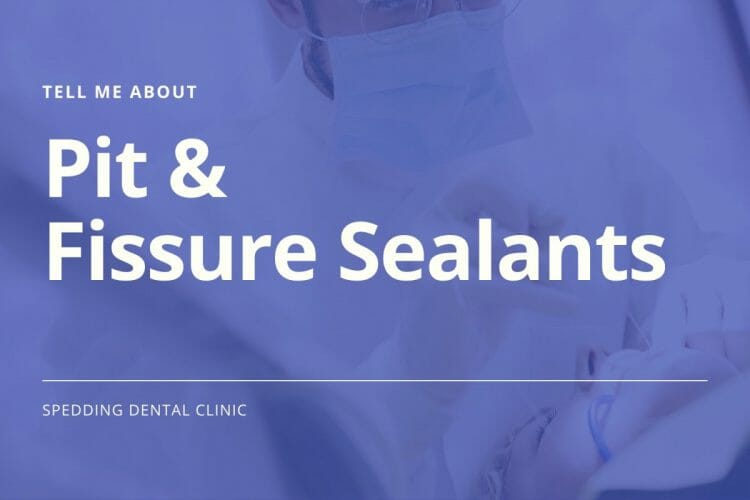Pit & Fissure Sealants