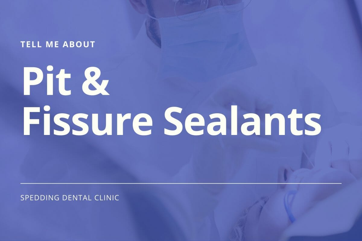 Pit & Fissure Sealants