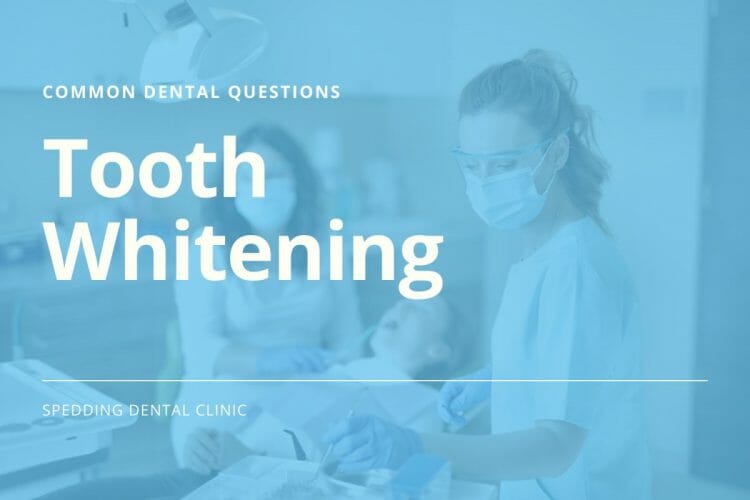 Common Dental Care Questions About Tooth Whitening