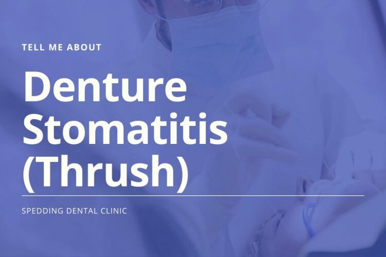 Tell Me About Denture Stomatitis (Thrush)