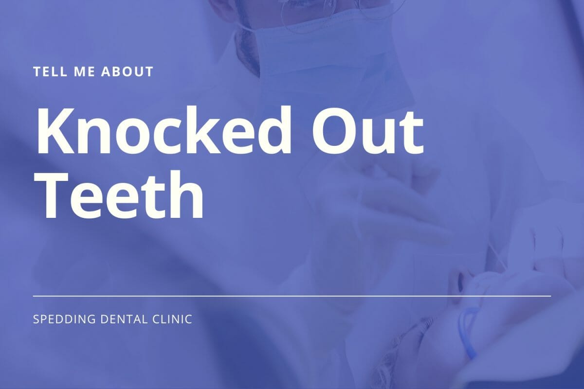 Knocked out teeth