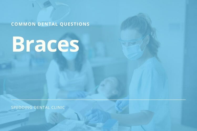 Common Dental Care Questions For Braces